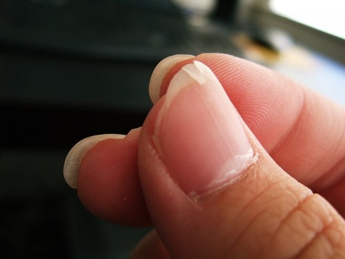 fingernail